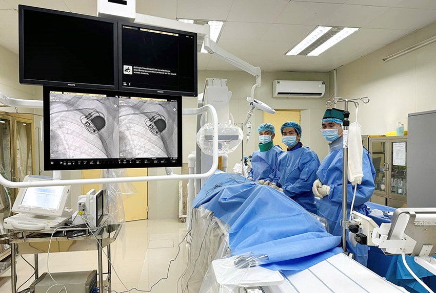 Bệnh viện Trường đại học Y - Dược đặt máy tạo nhịp hai buồng cho bệnh nhân với sự hỗ trợ của hệ thống máy chụp mạch số hóa xóa nền (DSA) hiện đại